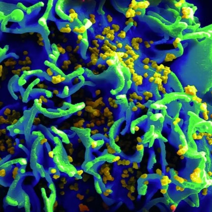 CultureEnJeu – La Claque: la culture fait partie des secteurs les plus violemment impactés par la pandémie de Covid-19.